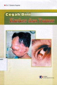 Cegah Dini Kanker dan Tumor